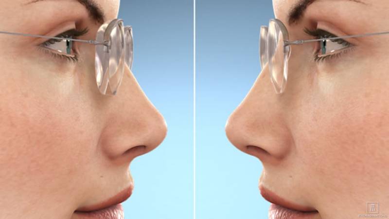 High Index Lenses - Goodrich Optical