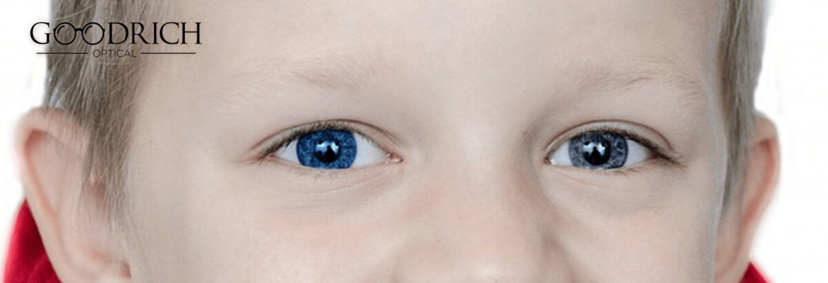 Heterochromia-GoodRich-Opticals-1200x410.jpg