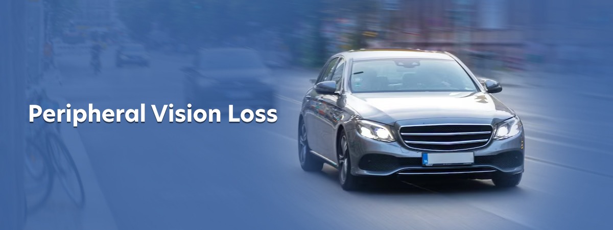 Common-Causes-of-Peripheral-Vision-Loss.jpg